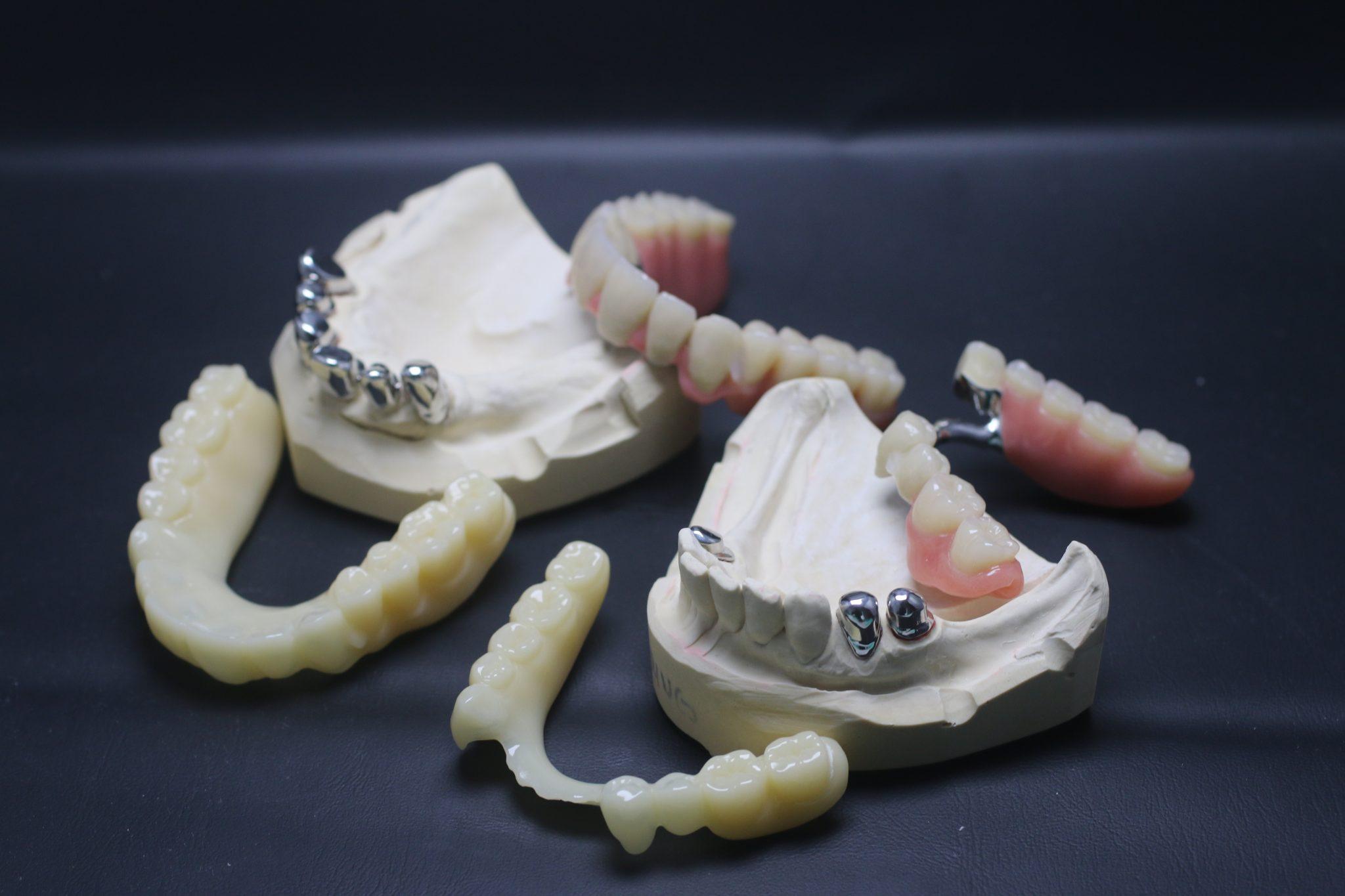 Teleskop-Sauganpassung